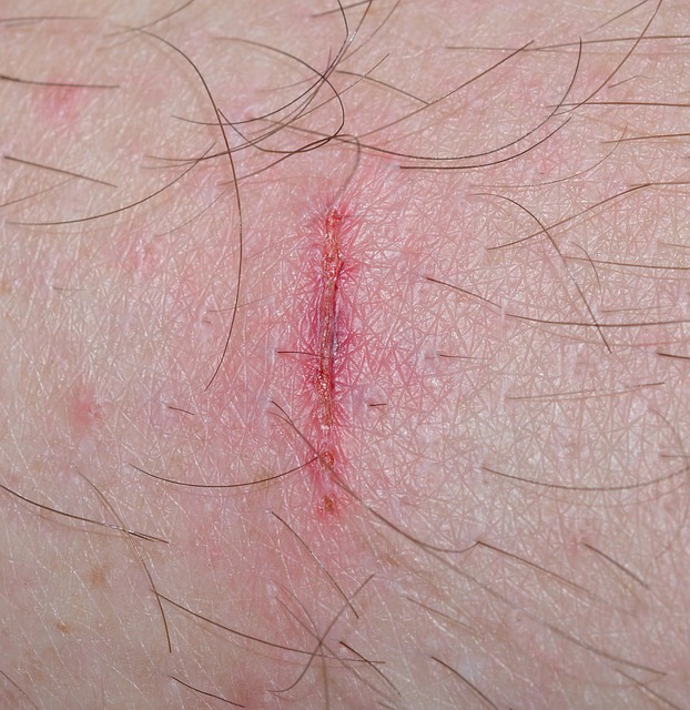 Spinal Ligament Injury Chiropractor